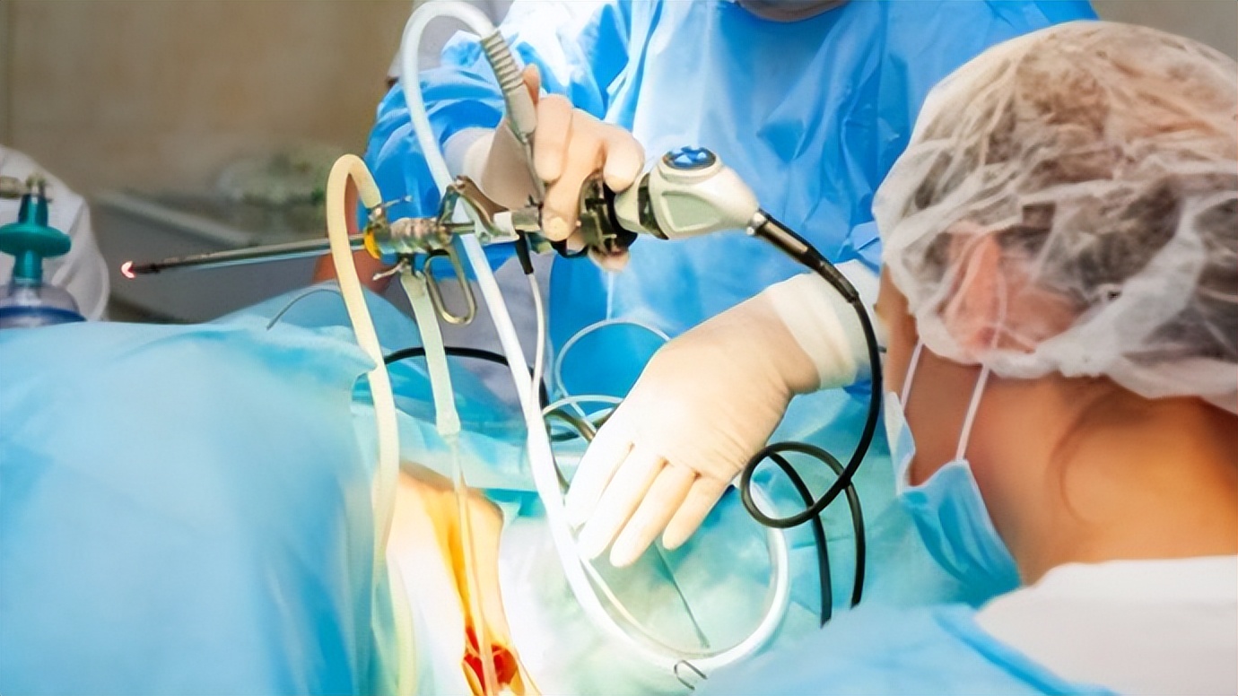 体检发现胆结石，胆囊到底切不切？