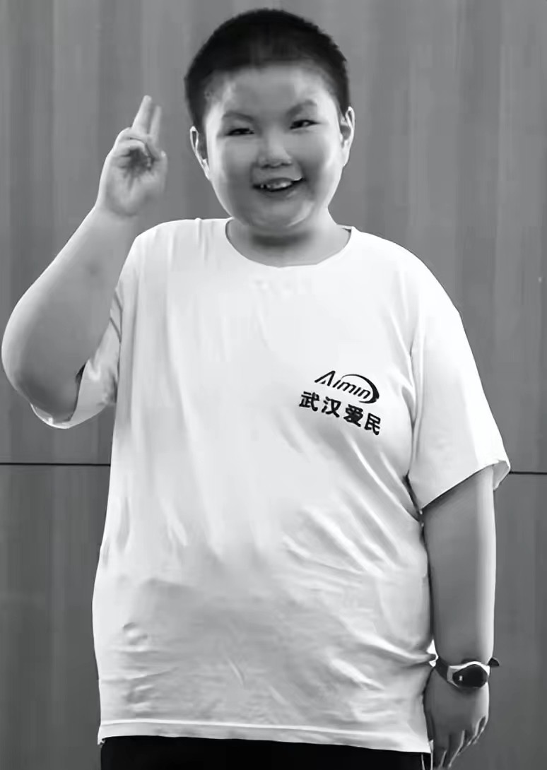 江西一男孩14岁达到300斤,10岁男孩一顿吃三碗体重飙到130斤