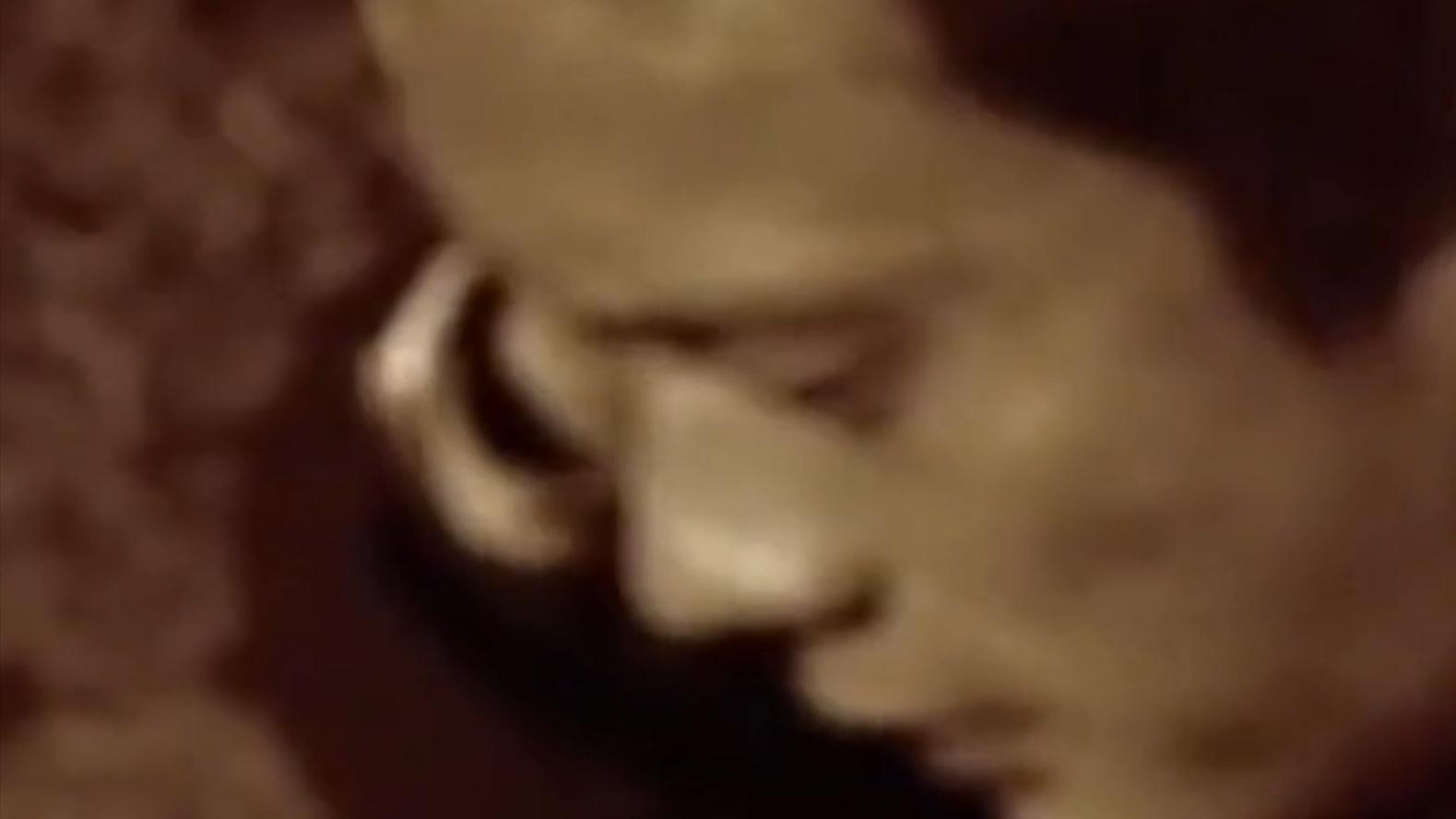 云南男子口臭手术后现在怎么样了,云南男子口臭查出了大毛病