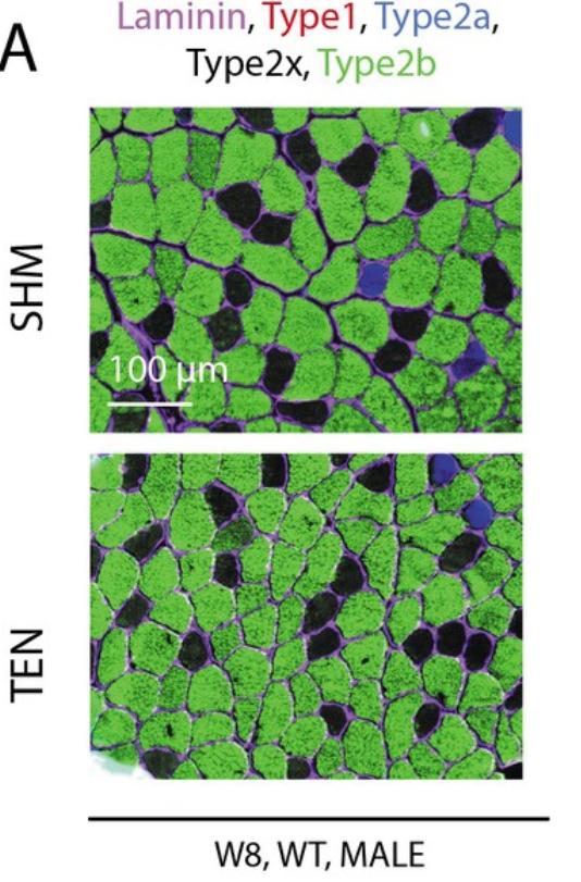 核因子,NFκB,在临床治疗上,是否与腱切断术的肌肉萎缩无关?