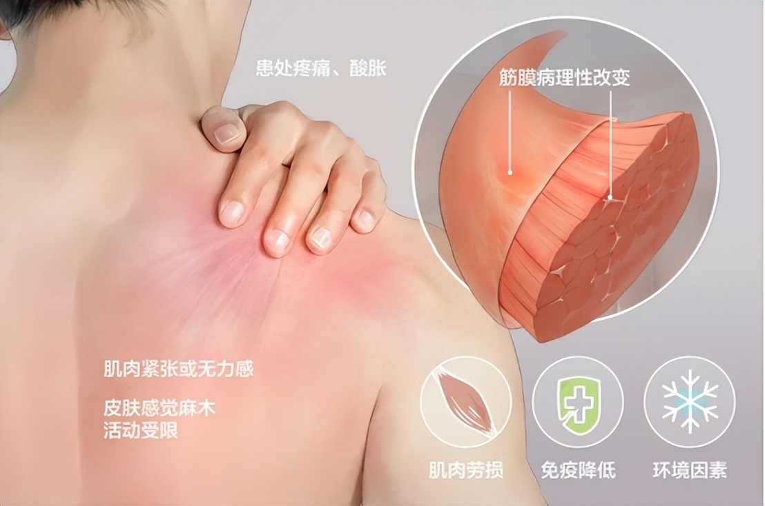 使用筋膜枪导致肌肉损伤怎么办,使用筋膜枪导致内脏受损