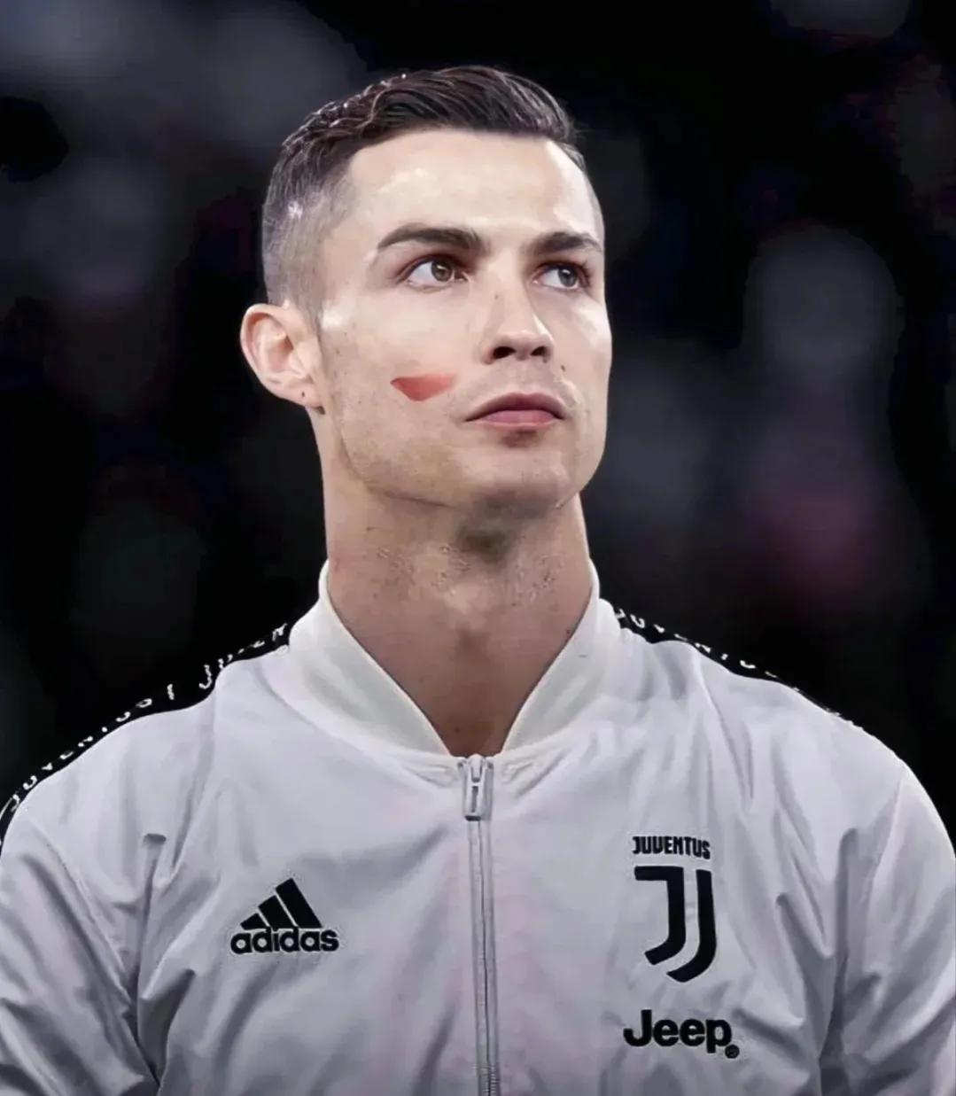 c罗内马尔在一个队吗,内马尔医美项目全过程