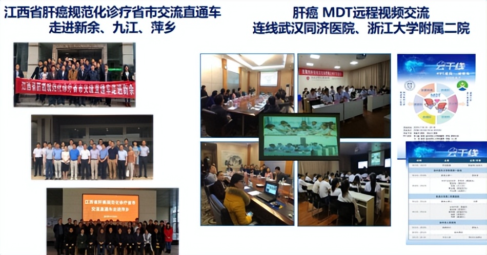 南昌二附院肝癌消融术,南昌市治疗肝癌水平最高医院