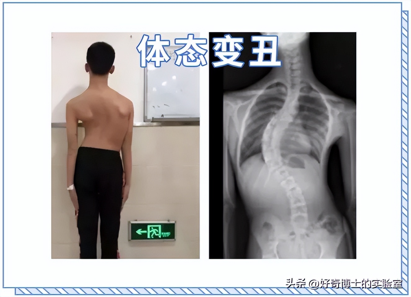 什么姿势能把腰掰响,哪些姿势对腰不好