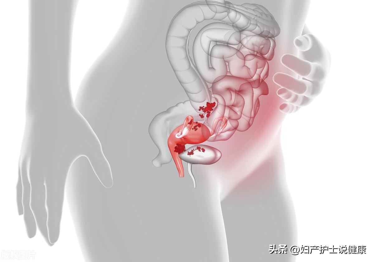 女性下腹痛看妇科还是内科,女性肚子疼看急诊还是门诊