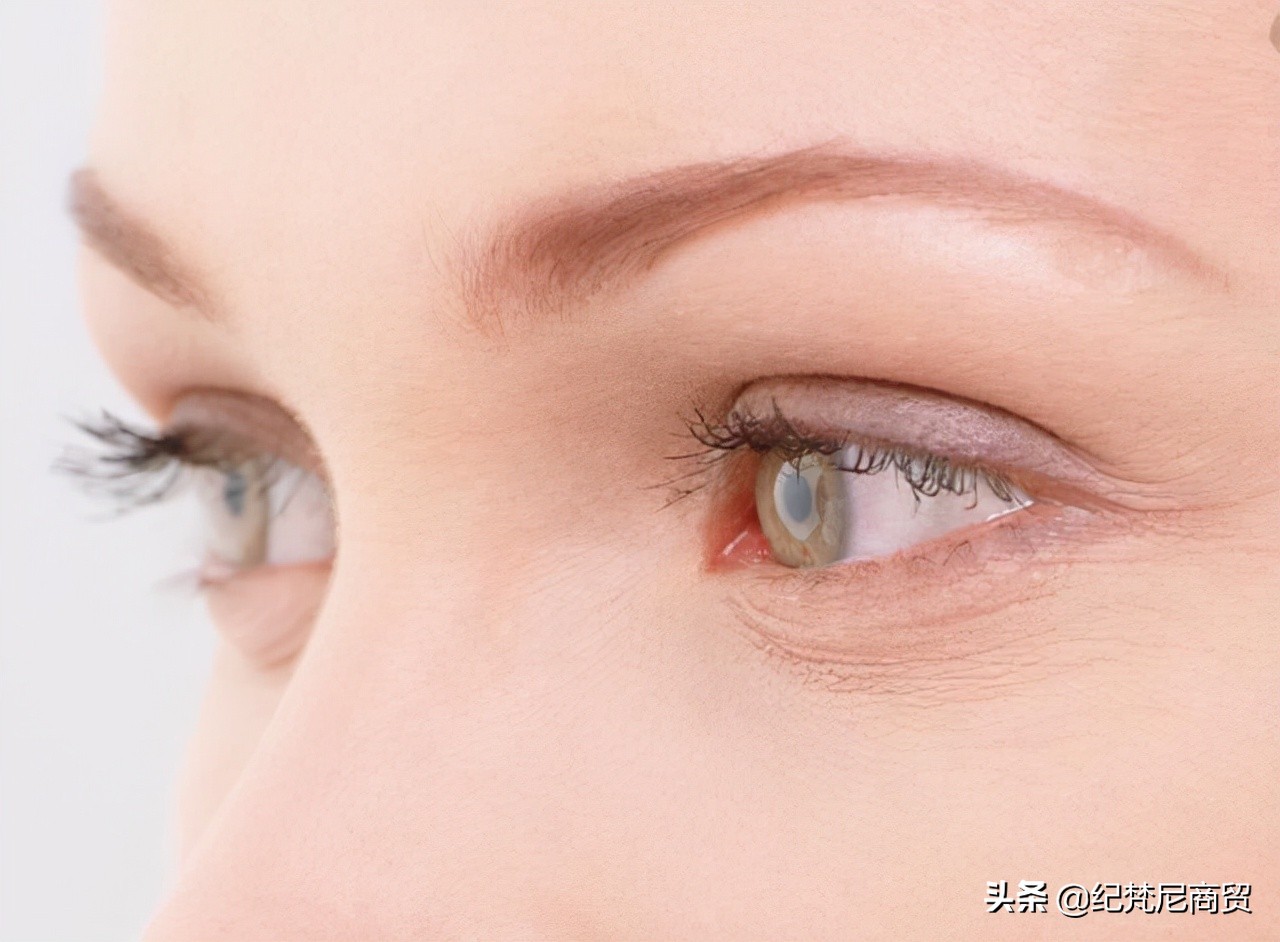让眼睛周围皱纹变平整的技巧,为什么眼睛周围起皱纹