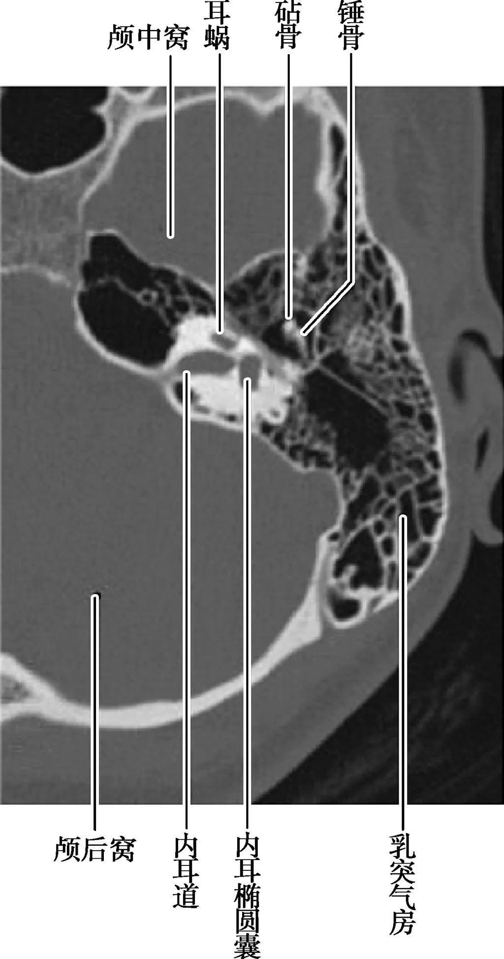 耳部解剖结构和生理功能,耳部解剖笔记