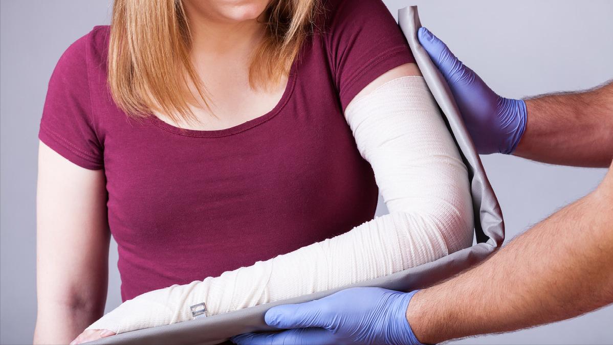 手腕骨折与桡骨远端骨折哪样严重,老年人手桡骨骨折多久能恢复