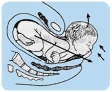 孕妈妈怎么判断胎位是正的,胎儿屁股在右侧是什么胎位