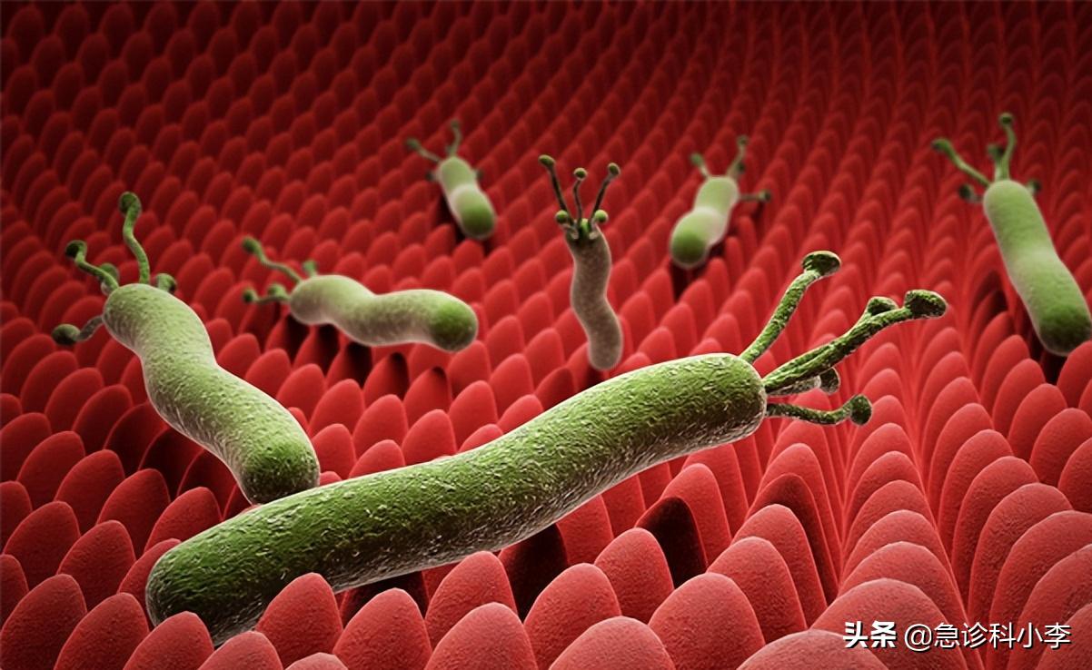 幽门螺杆菌是胃病的罪魁祸首吗,幽门螺杆菌一直治不好怎么办