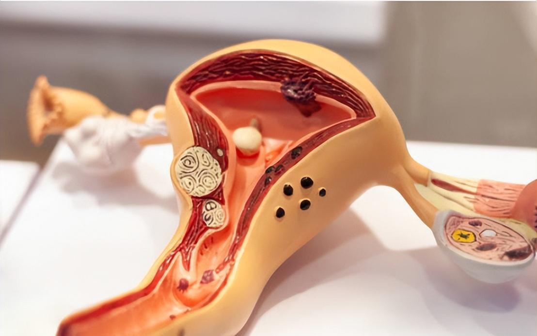 “五万一次，刺穿*体下**”？比*交性**易更可怕的是无*交性**易