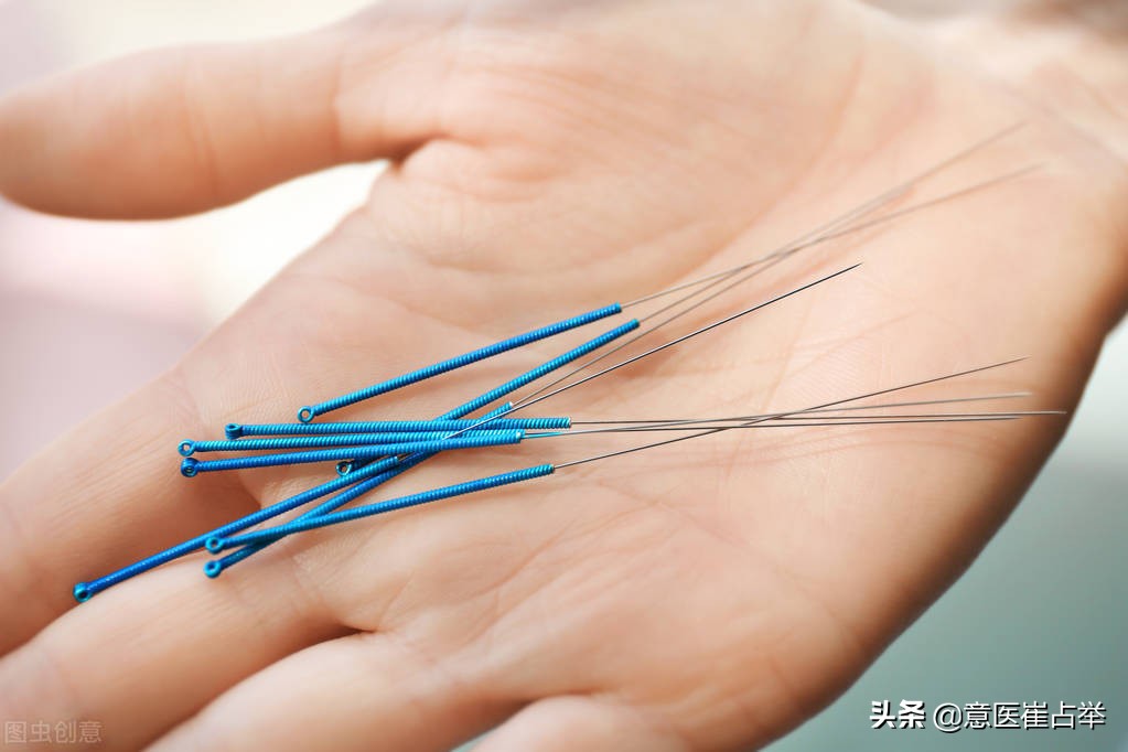 董氏奇穴针灸牵引针法的妙用,动气针法有效吗