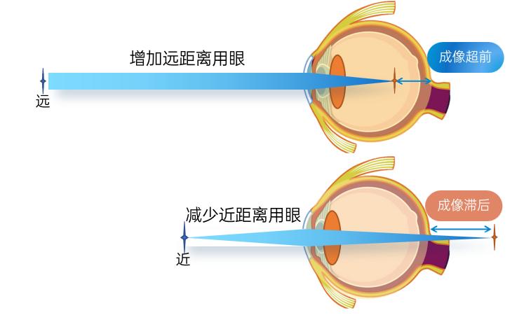 雾视镜和雾视屏一定要配套使用吗,雾视去雾视操作流程