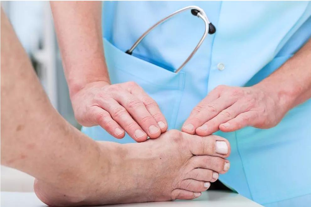 看痛风为啥中医要用西医常规检查,这些中药,调理指标异常更准确