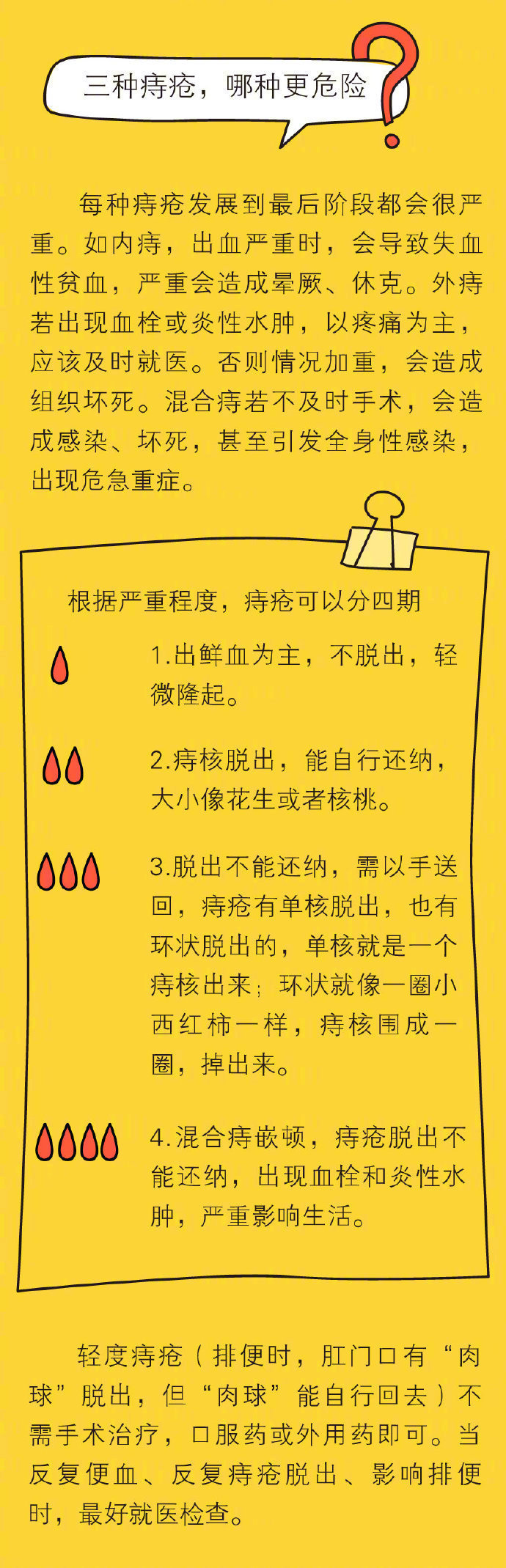 痔疮手术后清洗流程,微创痔疮手术后的护理流程