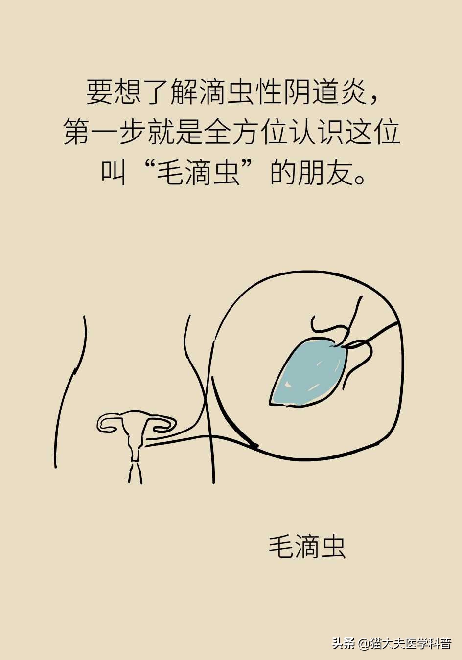 滴虫性阴道炎会不会没有症状,滴虫性阴道炎的症状会传染吗