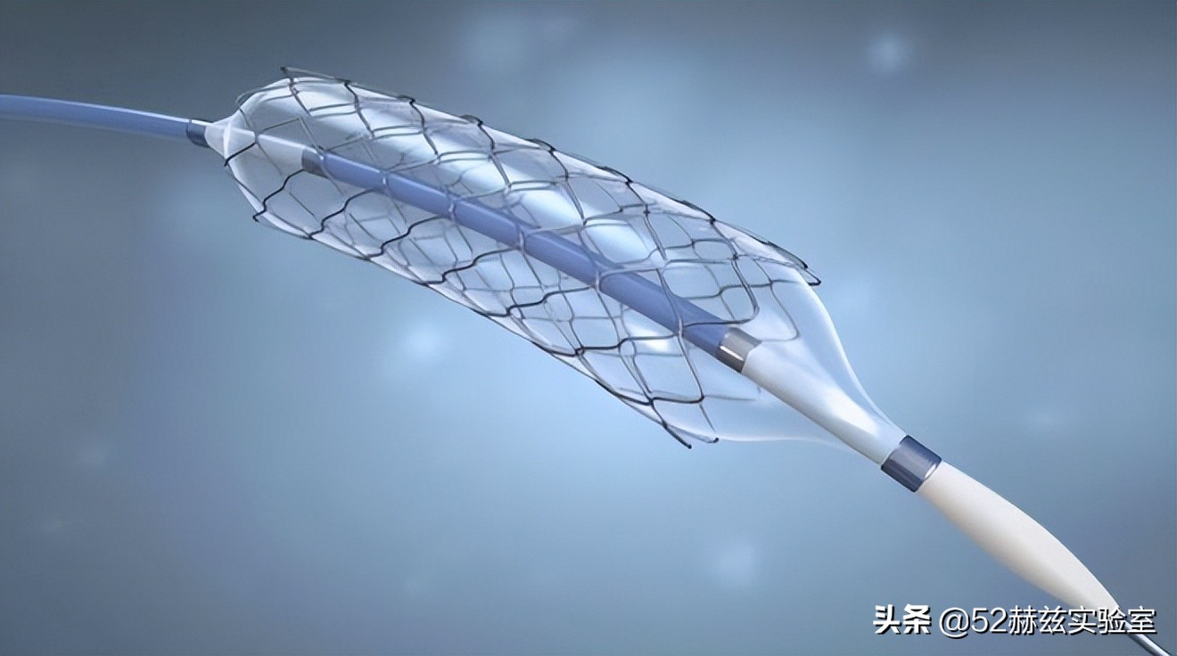 从13000元骤降至700元！看国产心脏支架如何吊打国外？