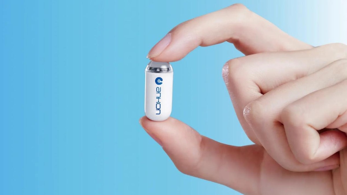 安翰磁控胶囊胃镜检查全流程,安翰磁控胶囊可以做胃镜吗