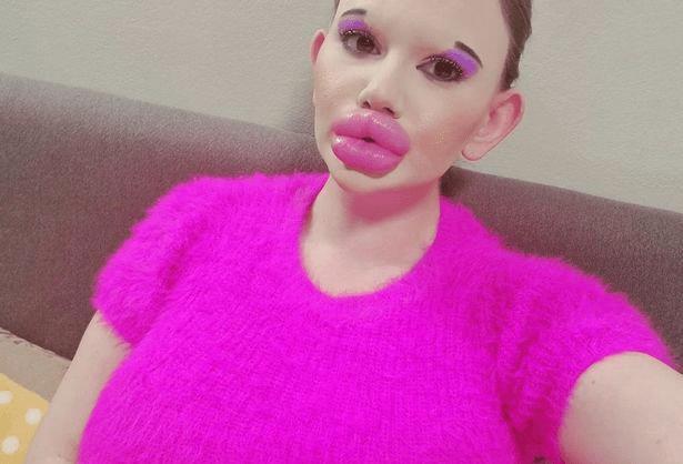 全网最厚嘴唇女网红,整容很多次网红厚嘴唇