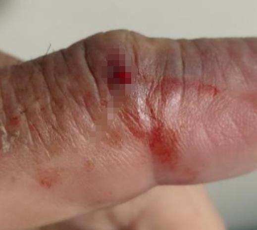 被蛇咬伤必死无疑的蛇,如果被蛇咬伤怎么判断蛇有没有毒