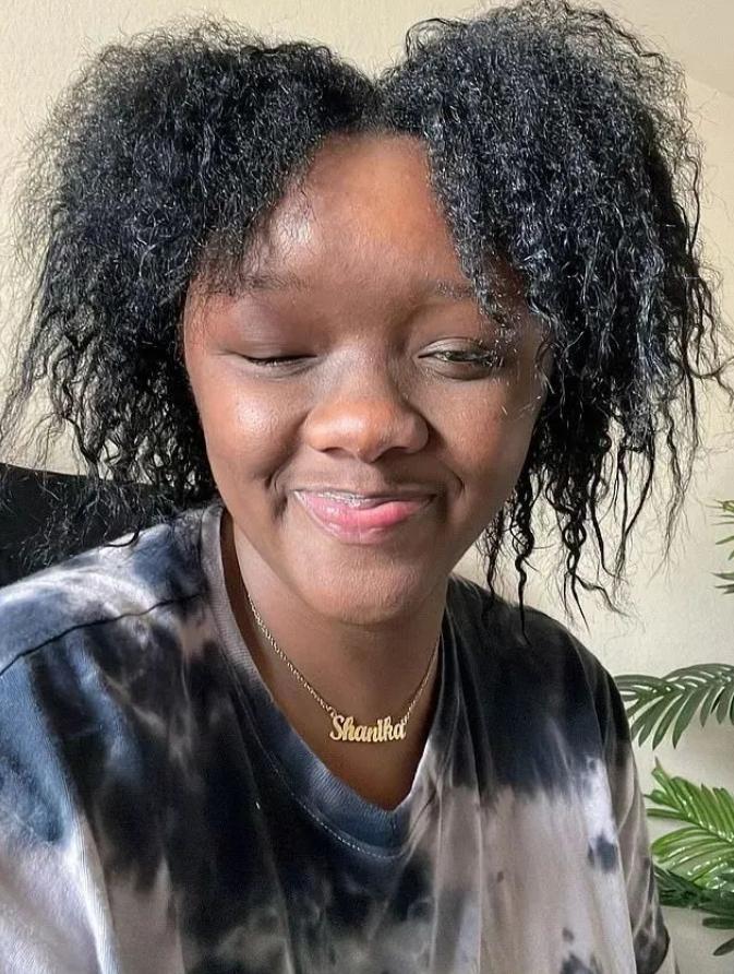 美国妹子染头发过敏全脸肿成emoji，不光失明还险些窒息