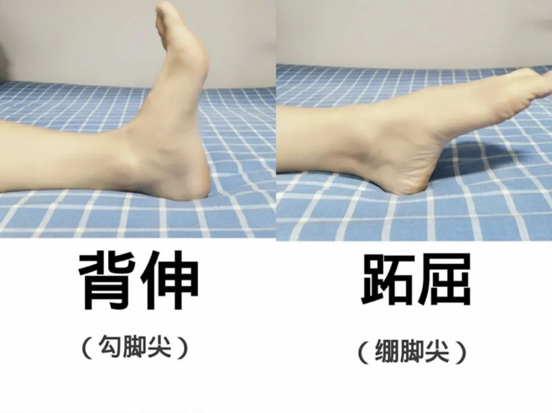 脚踝疼痛别大意，警惕这个疾病找上门！