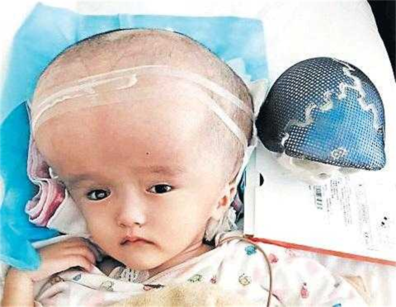 三聚氰胺奶粉事件有儿童死亡吗,三聚氰胺害死了多少人