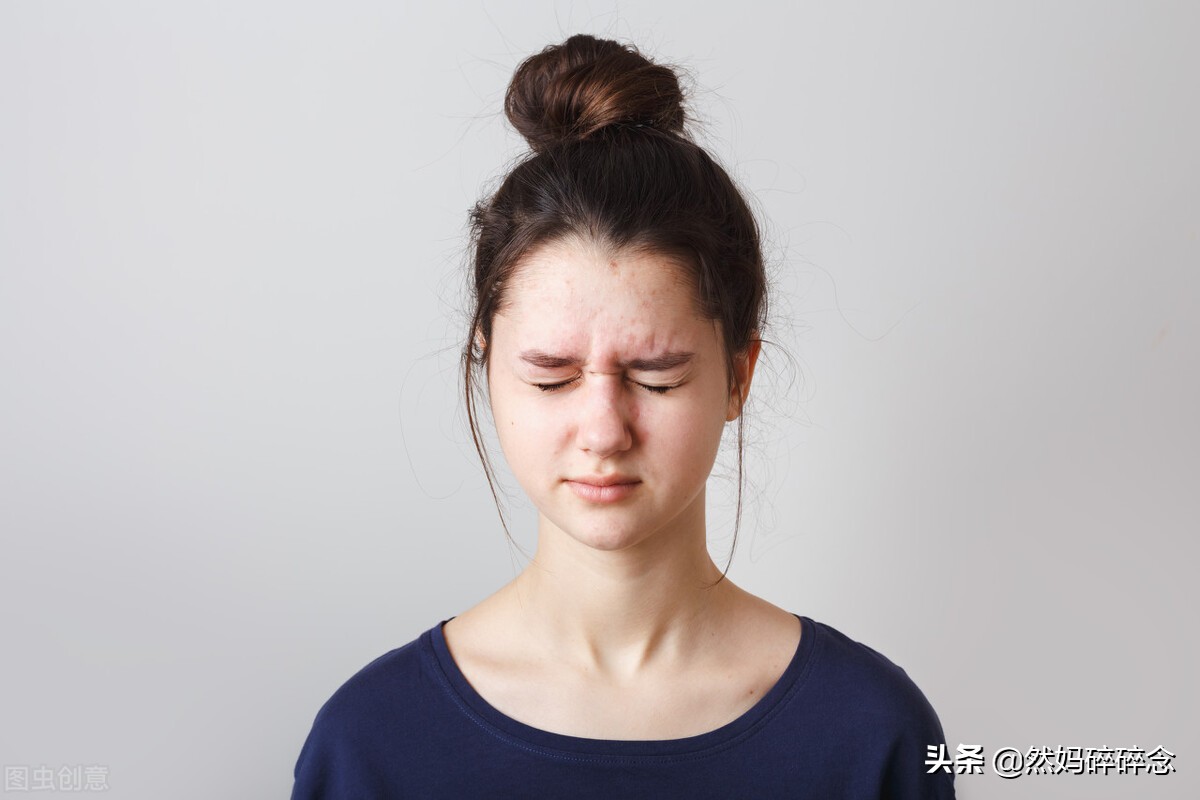 青春期孩子长痘怎么解决,青春期孩子长痘有什么好方法