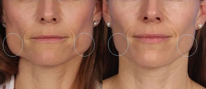 睡觉每晚都磨牙到底是什么原因,夜里睡觉一直磨牙是什么原因