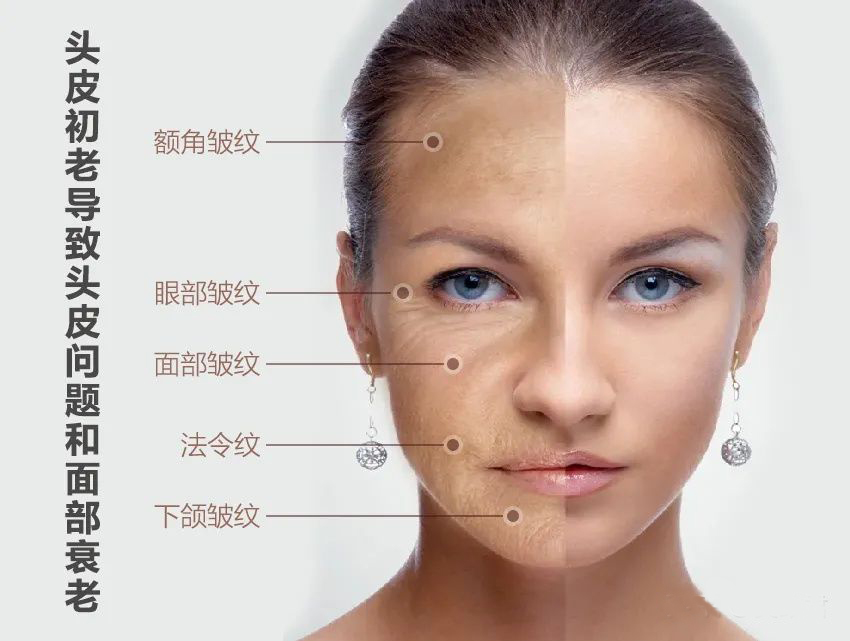 头皮松弛是衰老的前兆吗,头皮有紧箍感且越来越松弛