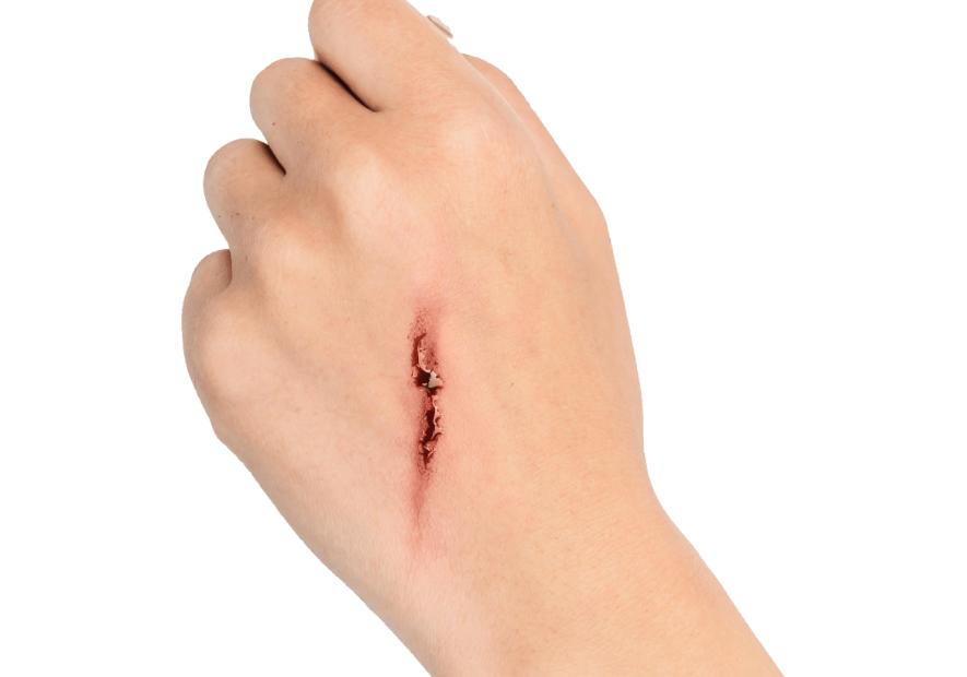 艾滋病的防治策略答案,艾滋病的元凶