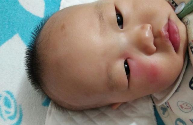 夏天蚊子多宝宝总是被咬,夏天宝宝老是被蚊子咬怎么驱蚊