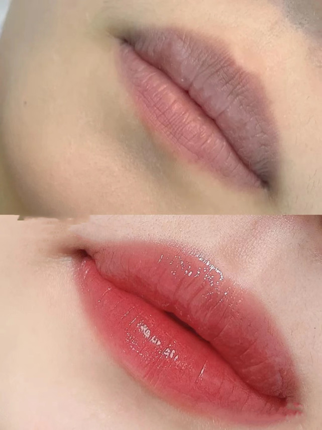 纹唇后不想要了纹唇失败怎么办,纹唇的注意事项具体有什么