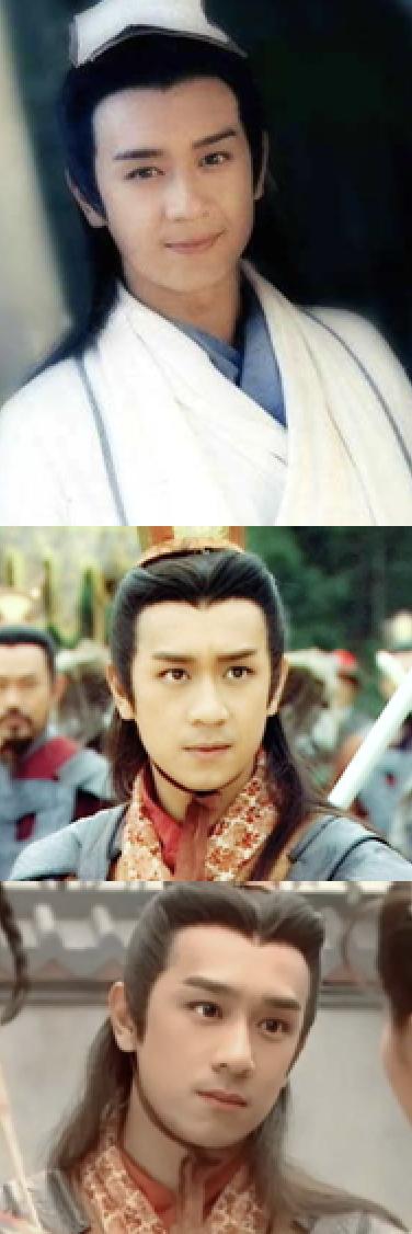 老演员整容脸变形,老年人整容前后照片