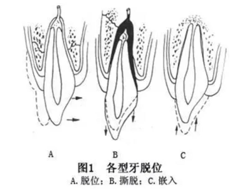 牙齿磕掉一半怎么确定伤到牙神经,八岁小孩牙齿磕掉了还能长出来吗
