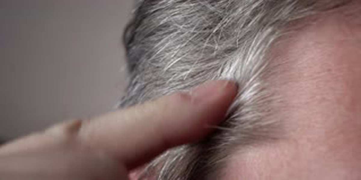 为什么30多岁的年轻人会长白头发,30多岁长白头发能恢复吗