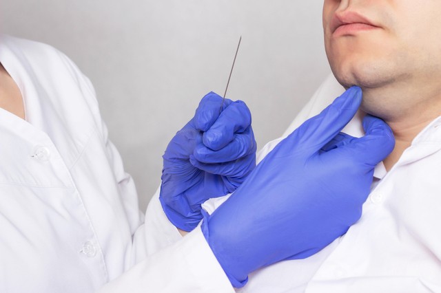 伤口缝合留疤还是不缝合留疤,可吸收的缝合线有疤痕吗