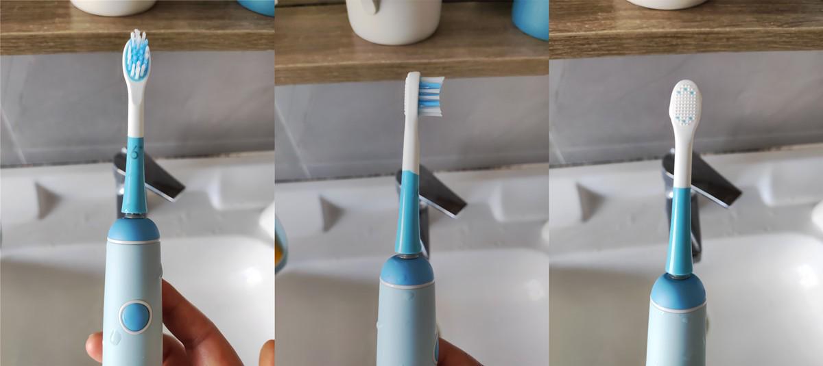 孩子满嘴小黑牙的原因,5岁小孩有小黑牙需要治疗吗