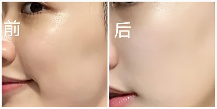 2021美白淡斑面膜十大排行榜口碑,祛痘印面膜真实测评有效第一名