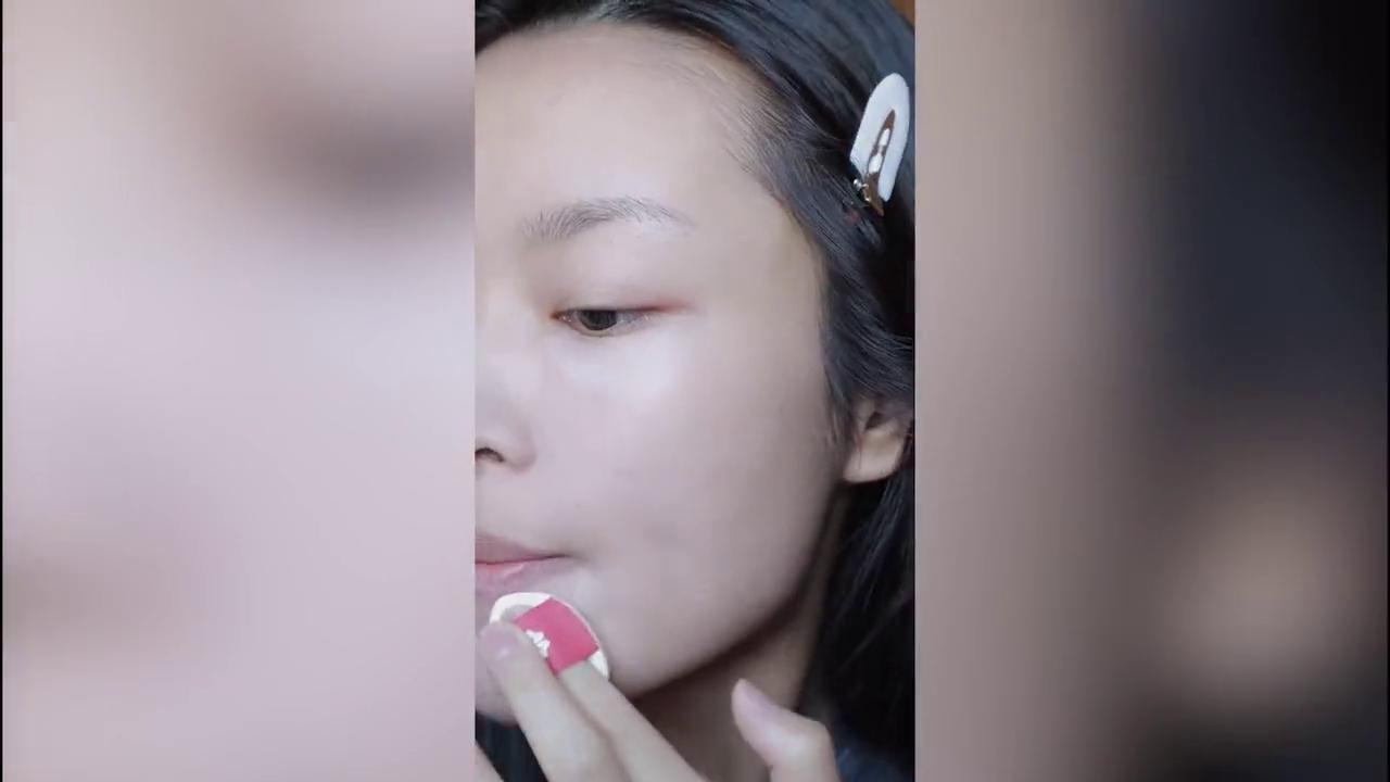 提升面部平整度,凹陷修复怎么找平整度