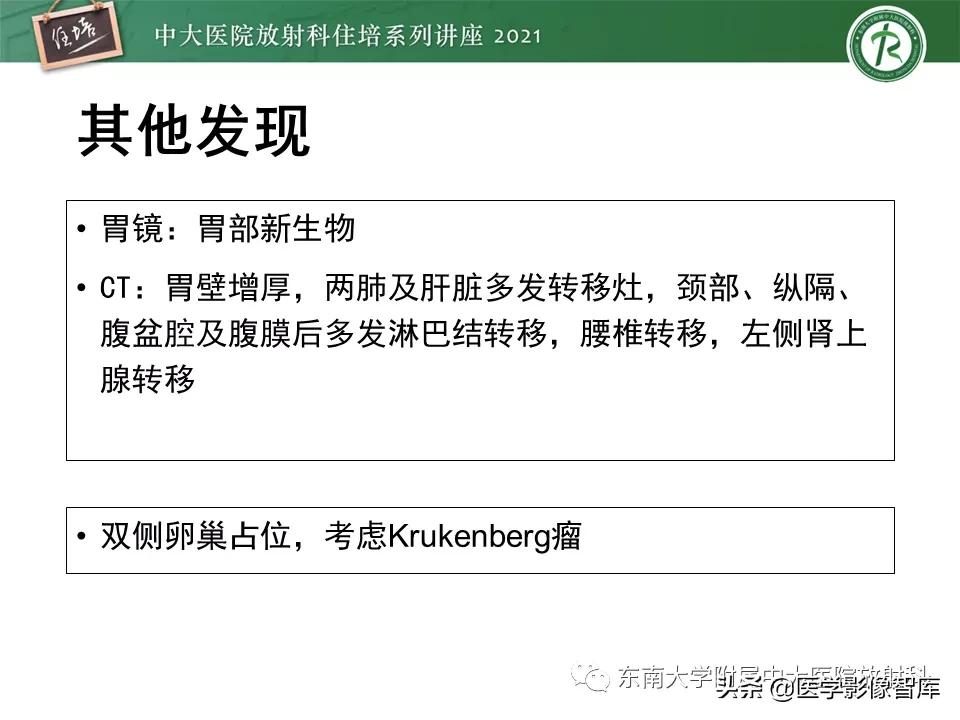 卵巢浆液性肿瘤的肉眼及镜下特征,卵巢原发性粘液性囊腺瘤