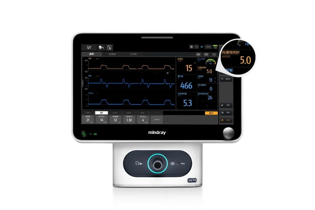 无创呼吸机一新亮点,无创通气和有创通气的优缺点
