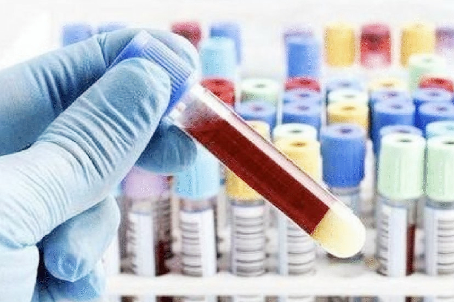 婴儿不认生谁抱都要怎么回事,宝宝不让妈妈抱的原因