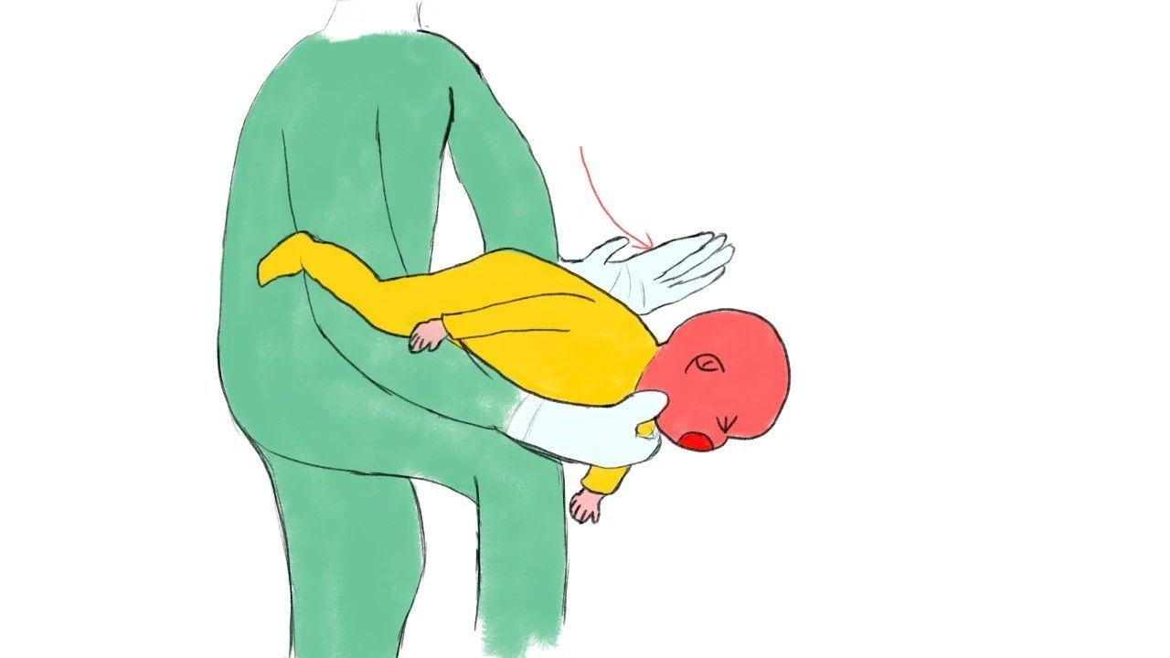 孩子被卡喉咙海姆立克急救法,小孩卡住喉咙海姆立克急救法视频