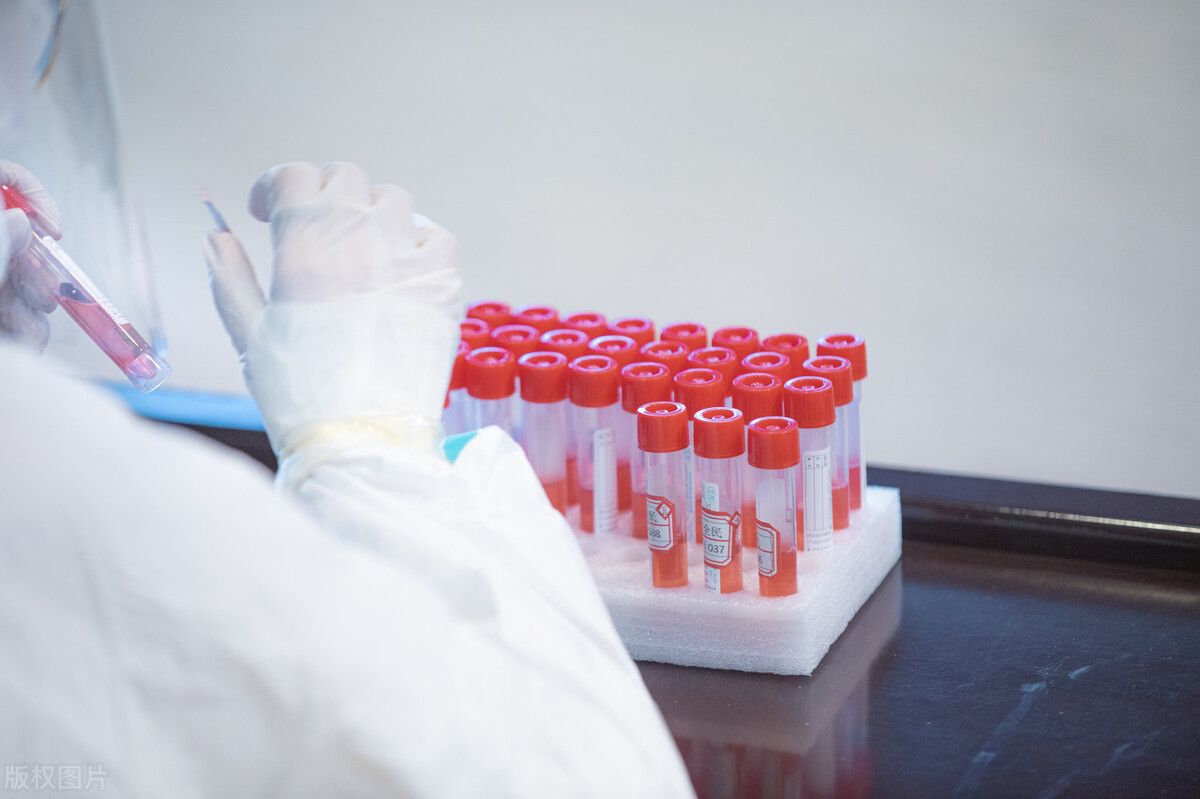 去日本旅游要学日语吗,日本留学的条件和要求