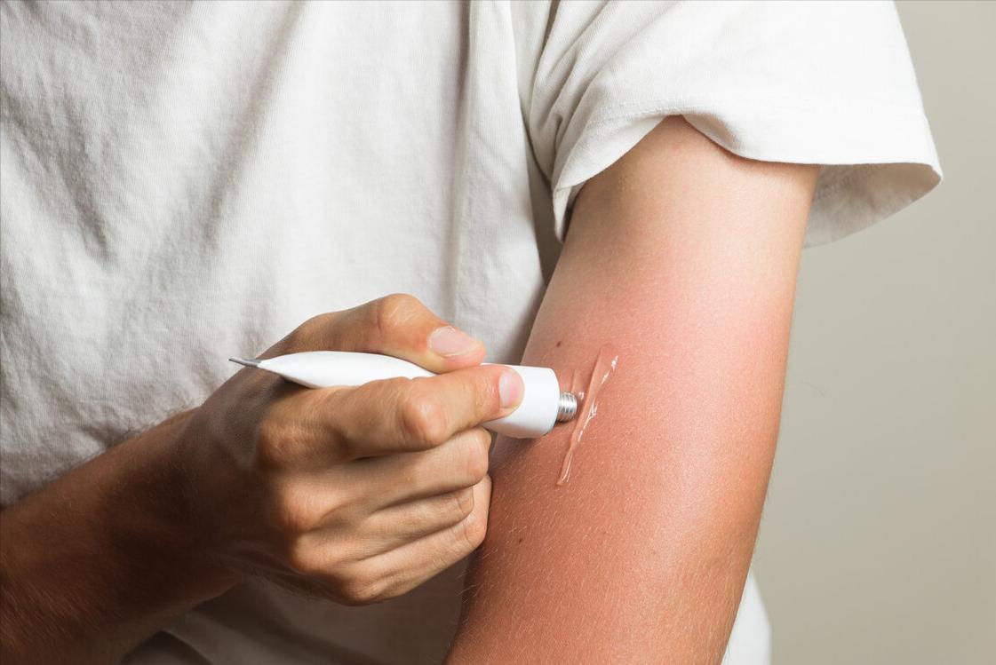 用红霉素软膏皮肤会变黑吗,用红霉素软膏擦一擦就好了