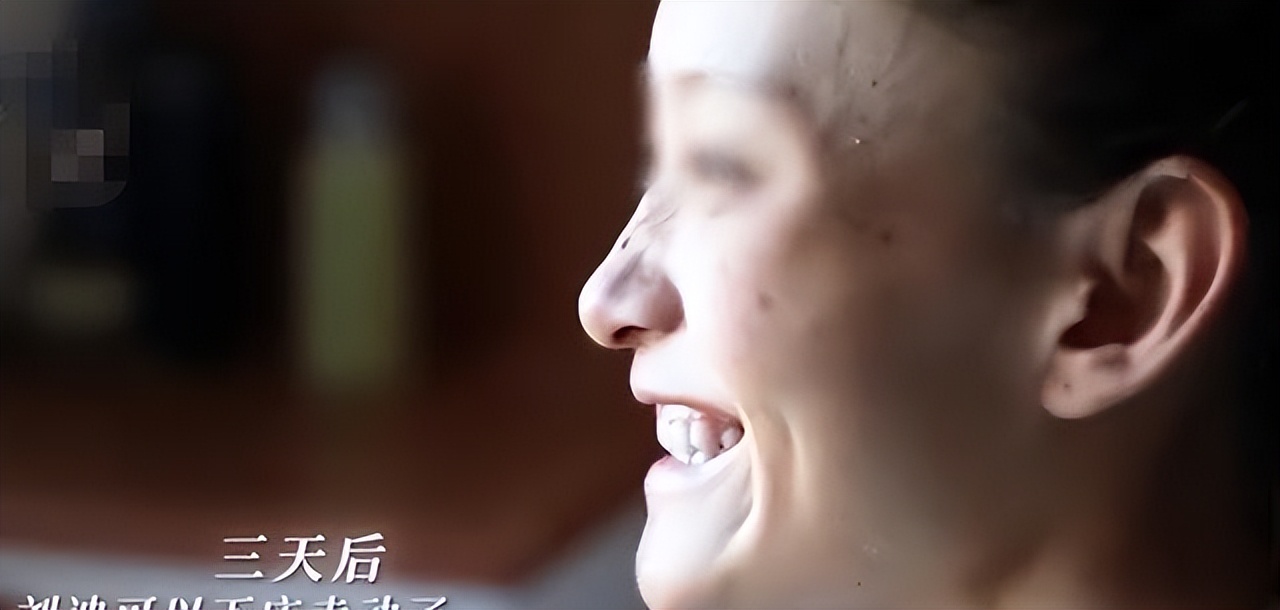 20岁女孩患虫癌死亡,少女患虫癌