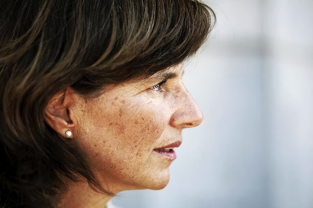 快速消除老年斑的小妙招红霉素,祛老年斑的最佳方法红霉素软膏