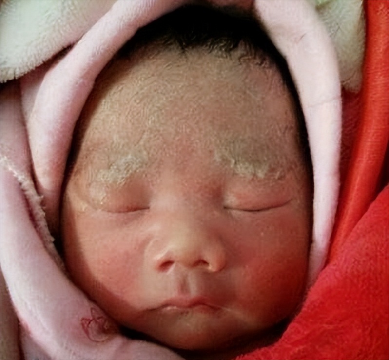 怎么可以让出生的宝宝皮肤白白的,刚出生的宝宝皮肤有哪些情况