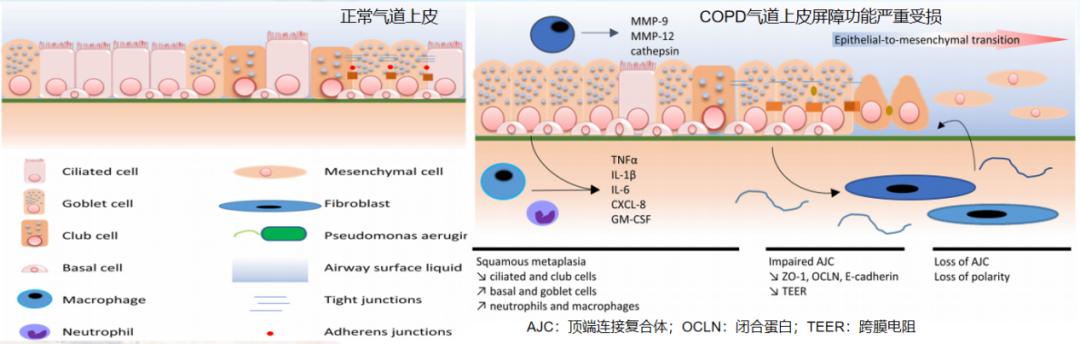 宋元林教授：「脆弱人群」即便打过疫苗，病毒仍能突破免疫屏障